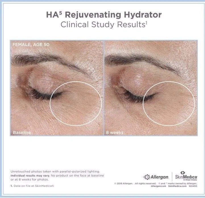 NEW Sealed SkinMedica HA5 Rejuvenating Hydrator - 2 oz.~ Authentic