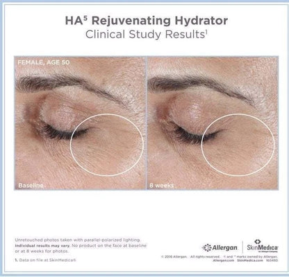 NEW Sealed SkinMedica HA5 Rejuvenating Hydrator - 2 oz.~ Authentic